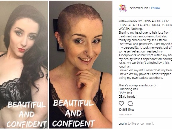 Milly Smith - @selfloveclub (185k followers) Body confidence activist Milly went viral after she candidly shared a post highlighting how deceptive photos can be by showing two different images of...